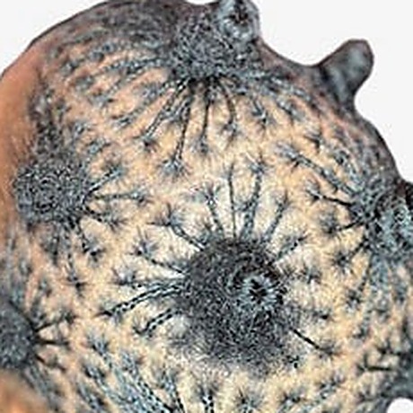 A close grid of small, evenly spaced partings across the crown of the head.